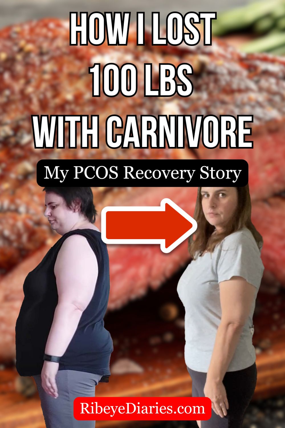 How I lost 100 lbs on the Carnivore diet - My PCOS recovery story
